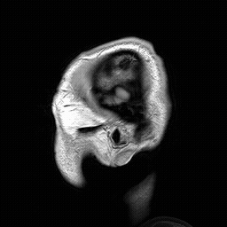 Animated MRI scan slices